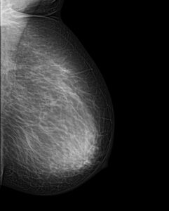 mamoexpert2-241x300.jpg mamoexpert2-241x300.jpg