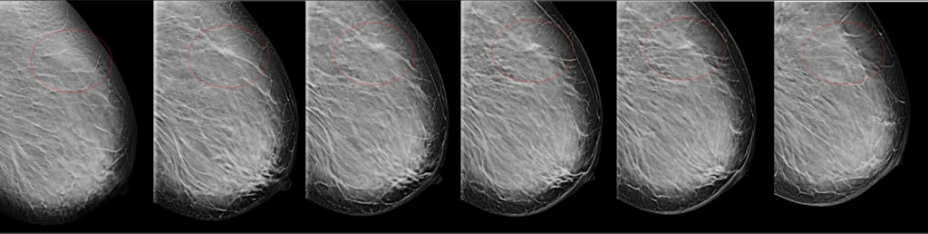 mamoexpert3-1600x403.jpg mamoexpert3-1600x403.jpg